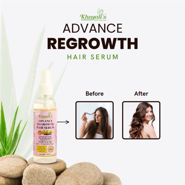 Advance Regrowth Hair Serum - 100 ML